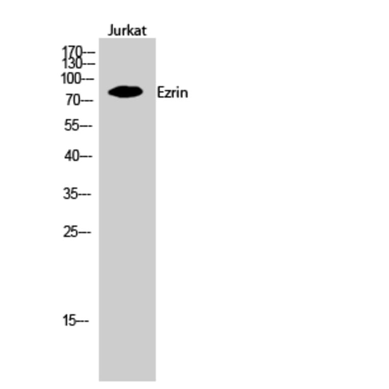 Western Blot - Anti-Ezrin Antibody (B8031) - Antibodies.com