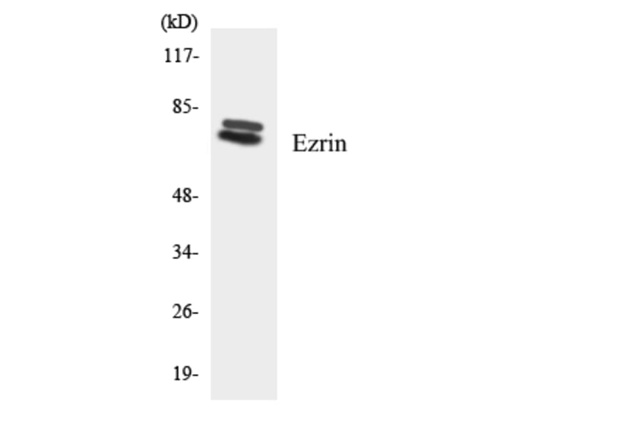 Western Blot - Anti-Ezrin Antibody (R12-2760) - Antibodies.com