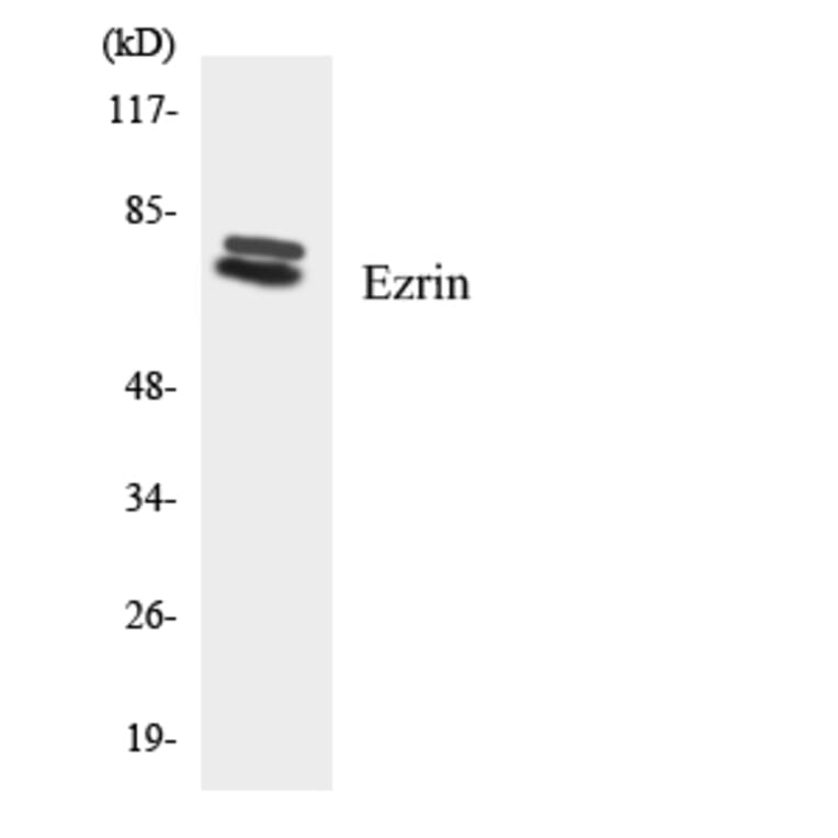 Western Blot - Anti-Ezrin Antibody (R12-2760) - Antibodies.com