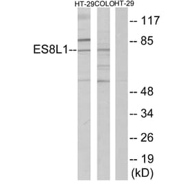 Western Blot - Anti-ES8L1 Antibody (C11395) - Antibodies.com