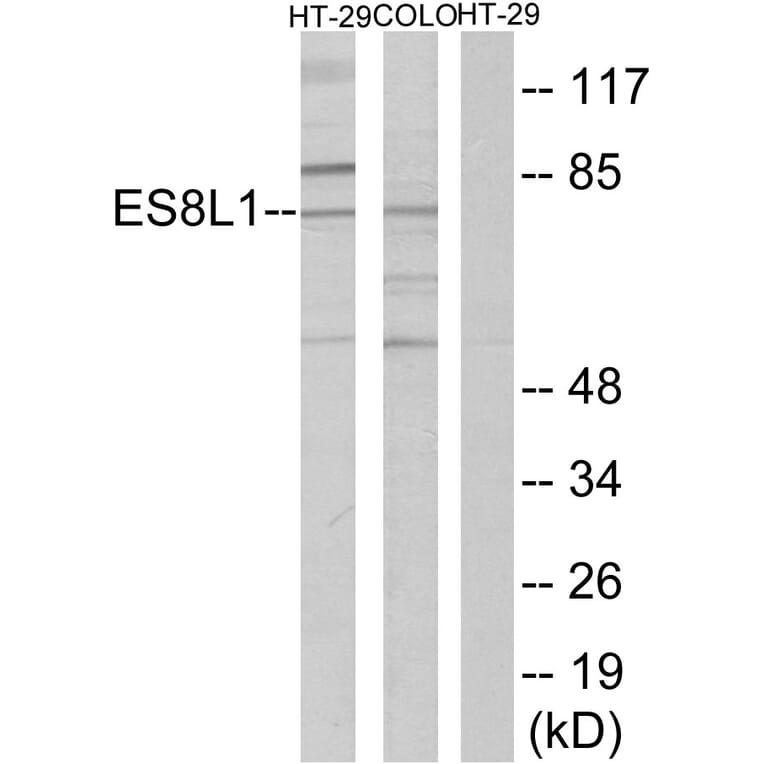 Western Blot - Anti-ES8L1 Antibody (C11395) - Antibodies.com