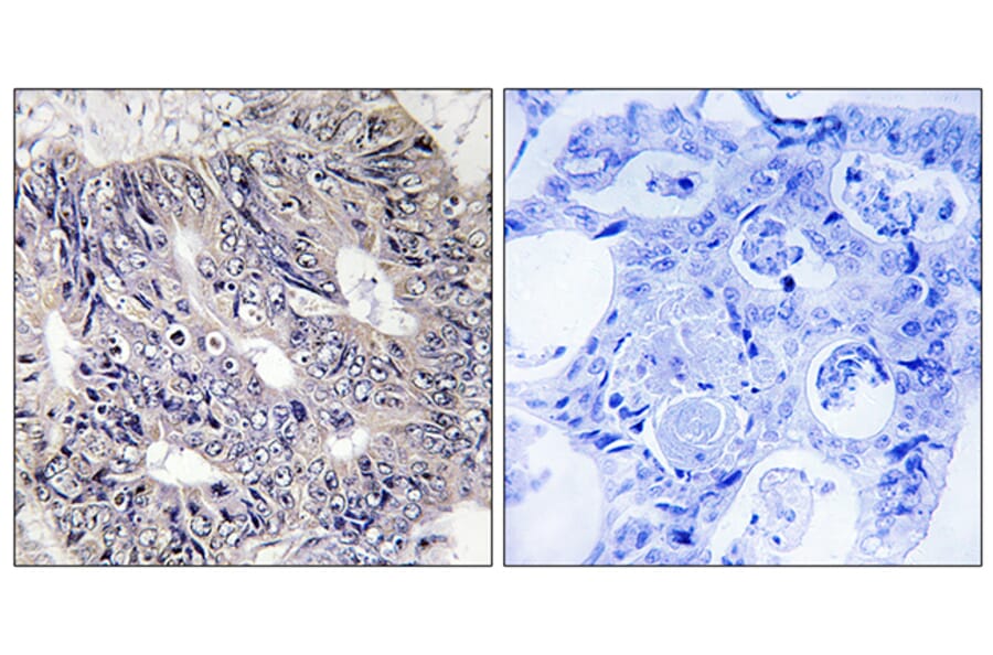Immunohistochemistry - Anti-ES8L1 Antibody (C11395) - Antibodies.com