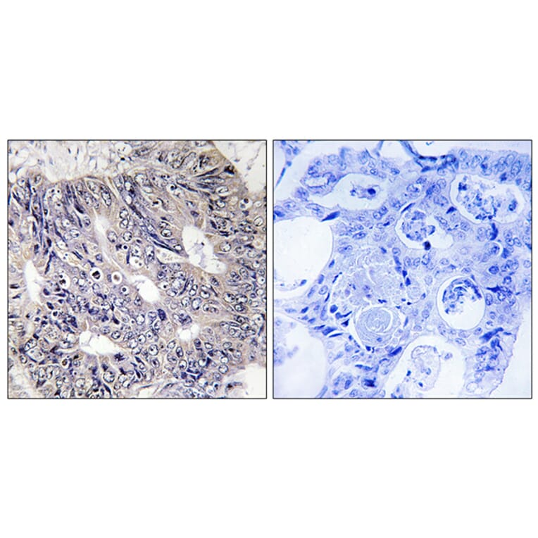 Immunohistochemistry - Anti-ES8L1 Antibody (C11395) - Antibodies.com