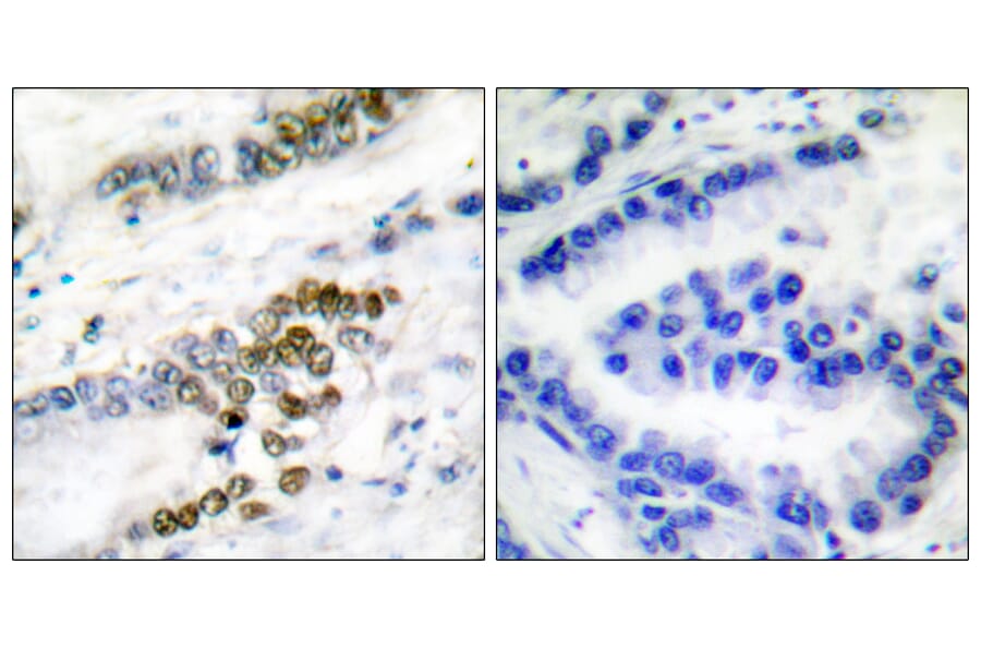 Immunohistochemistry - Anti-ERCC1 Antibody (C0184) - Antibodies.com
