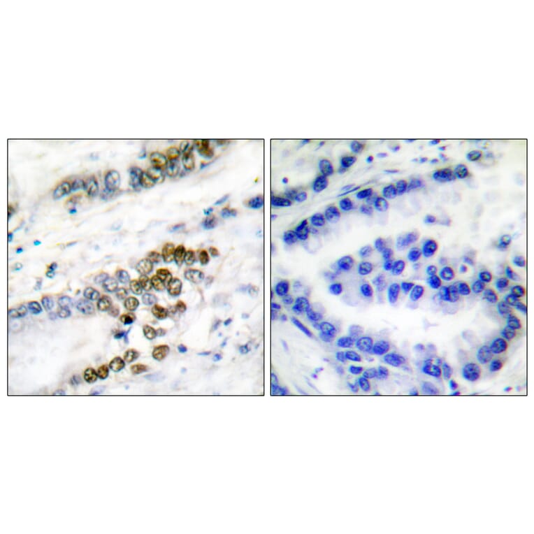 Immunohistochemistry - Anti-ERCC1 Antibody (C0184) - Antibodies.com