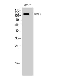 Western Blot - Anti-EPHB1 Antibody (C21143) - Antibodies.com