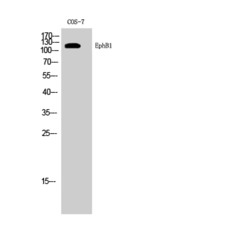 Western Blot - Anti-EPHB1 Antibody (C21143) - Antibodies.com