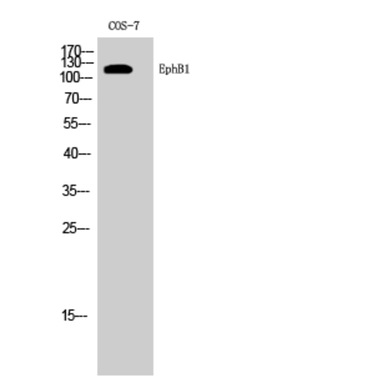 Western Blot - Anti-EPHB1 Antibody (C21143) - Antibodies.com