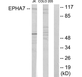Western Blot - Anti-EPHA7 Antibody (C11078) - Antibodies.com