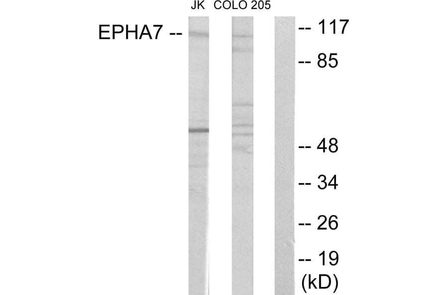 Western Blot - Anti-EPHA7 Antibody (C11078) - Antibodies.com