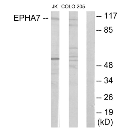 Western Blot - Anti-EPHA7 Antibody (C11078) - Antibodies.com