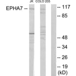 Western Blot - Anti-EPHA7 Antibody (C11078) - Antibodies.com