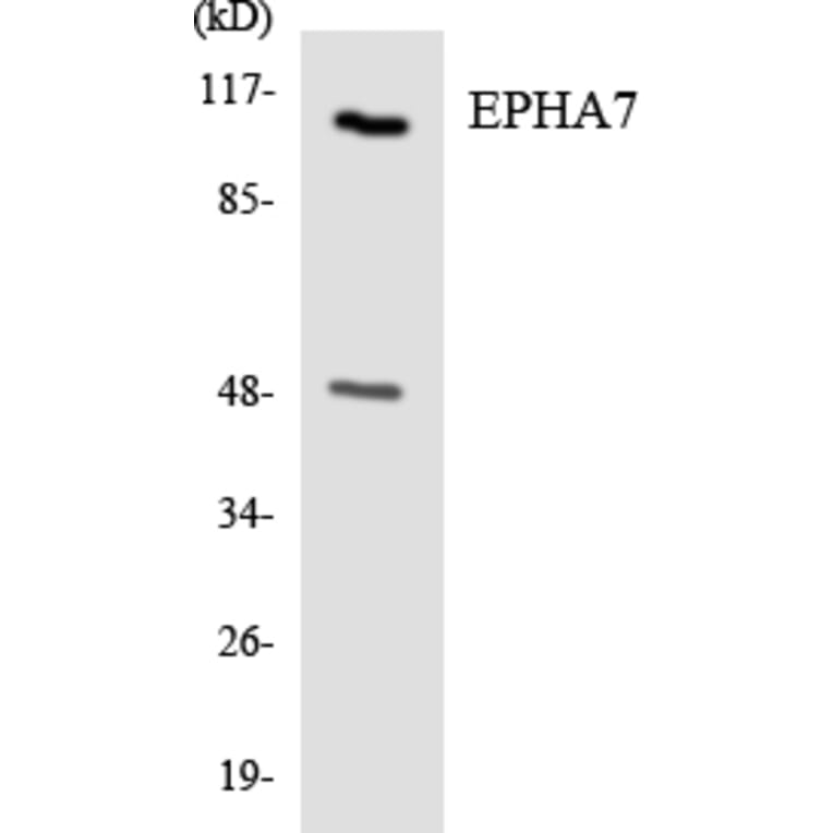 Western Blot - Anti-EPHA7 Antibody (R12-2753) - Antibodies.com