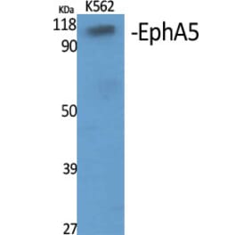Western Blot - Anti-EPHA5 Antibody (C21141) - Antibodies.com