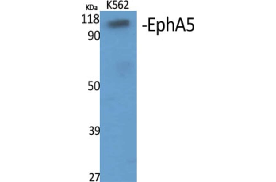 Western Blot - Anti-EPHA5 Antibody (C21141) - Antibodies.com