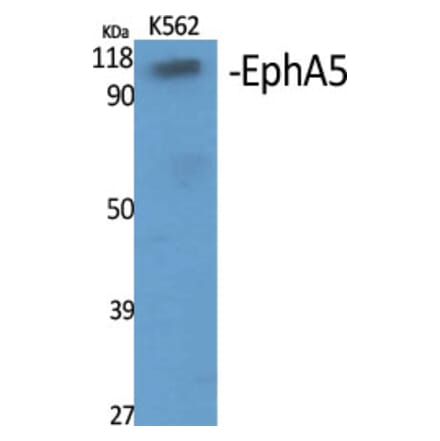 Western Blot - Anti-EPHA5 Antibody (C21141) - Antibodies.com