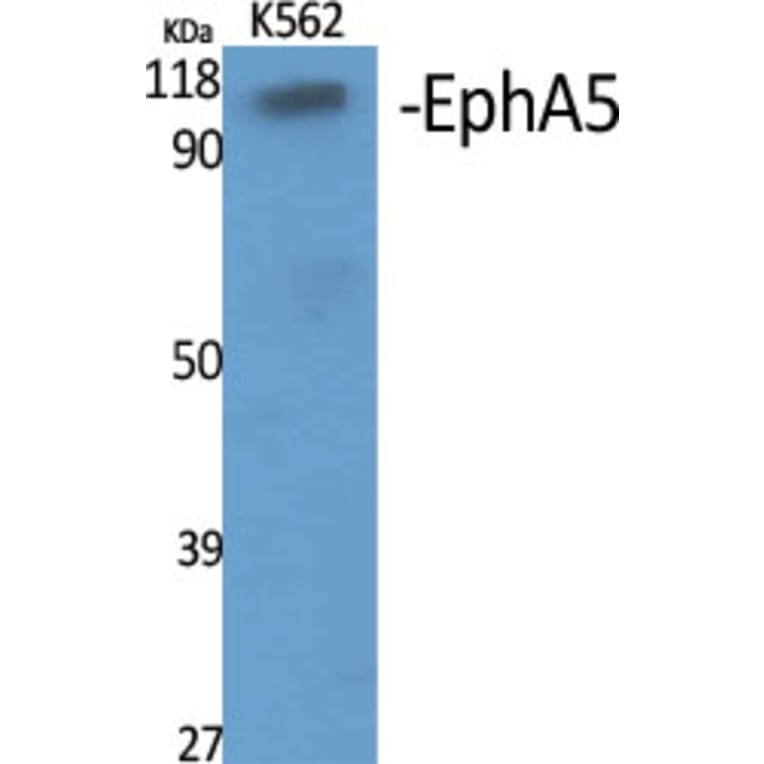 Western Blot - Anti-EPHA5 Antibody (C21141) - Antibodies.com