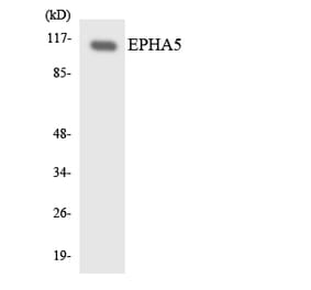 Western Blot - Anti-EPHA5 Antibody (R12-2752) - Antibodies.com