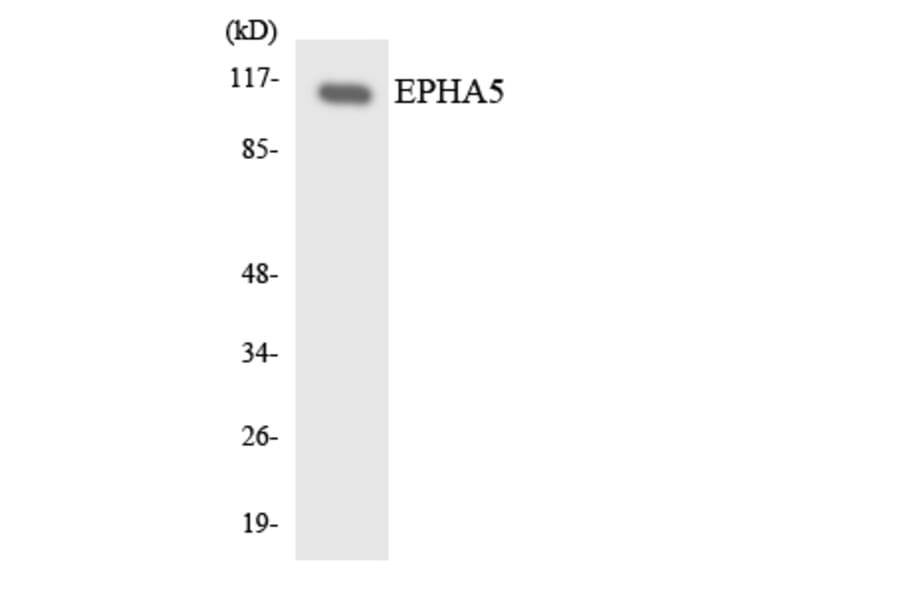 Western Blot - Anti-EPHA5 Antibody (R12-2752) - Antibodies.com