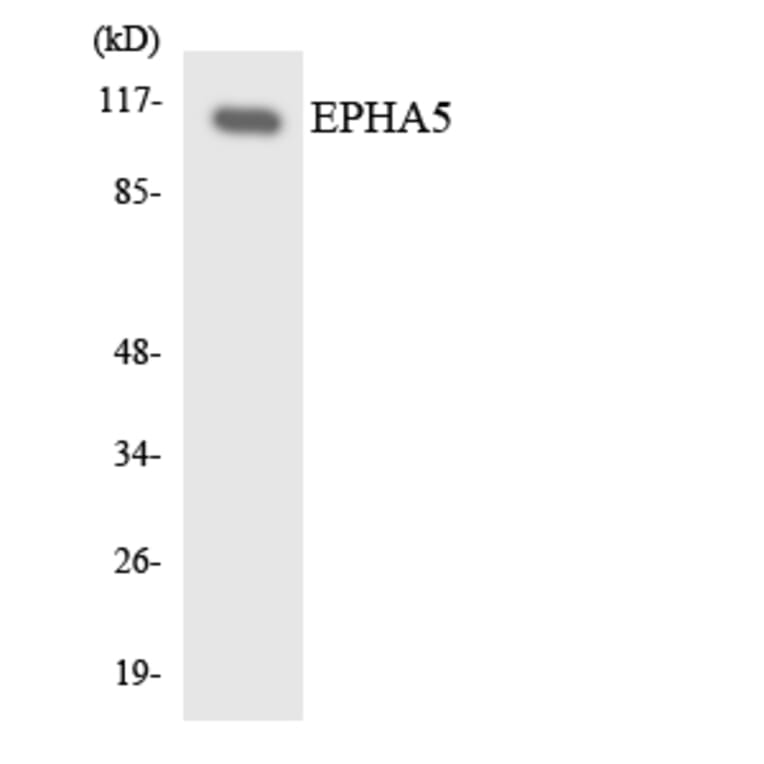 Western Blot - Anti-EPHA5 Antibody (R12-2752) - Antibodies.com