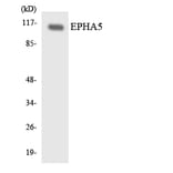 Western Blot - Anti-EPHA5 Antibody (R12-2752) - Antibodies.com