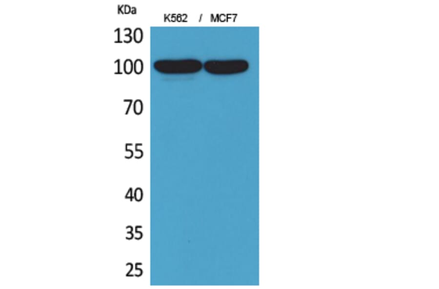 Western Blot - Anti-ENPP3 Antibody (C30491) - Antibodies.com