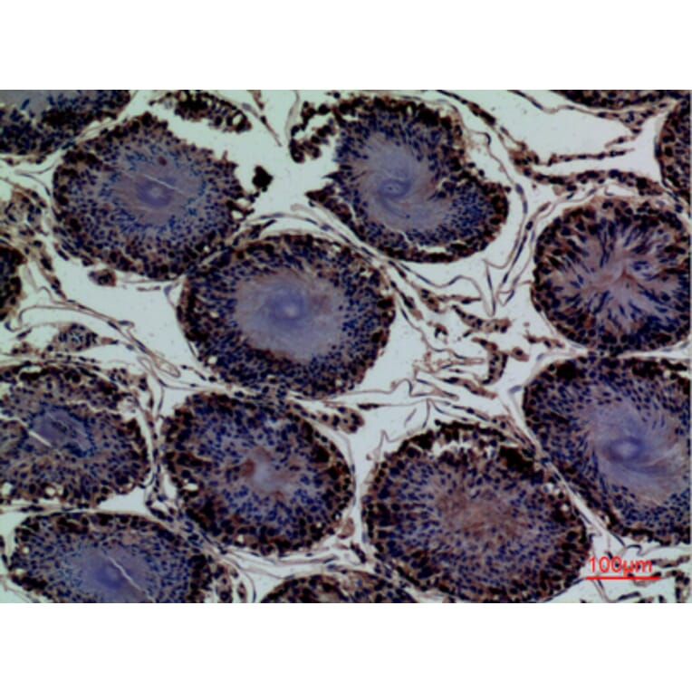 Immunohistochemistry - Anti-ENPP3 Antibody (C30491) - Antibodies.com