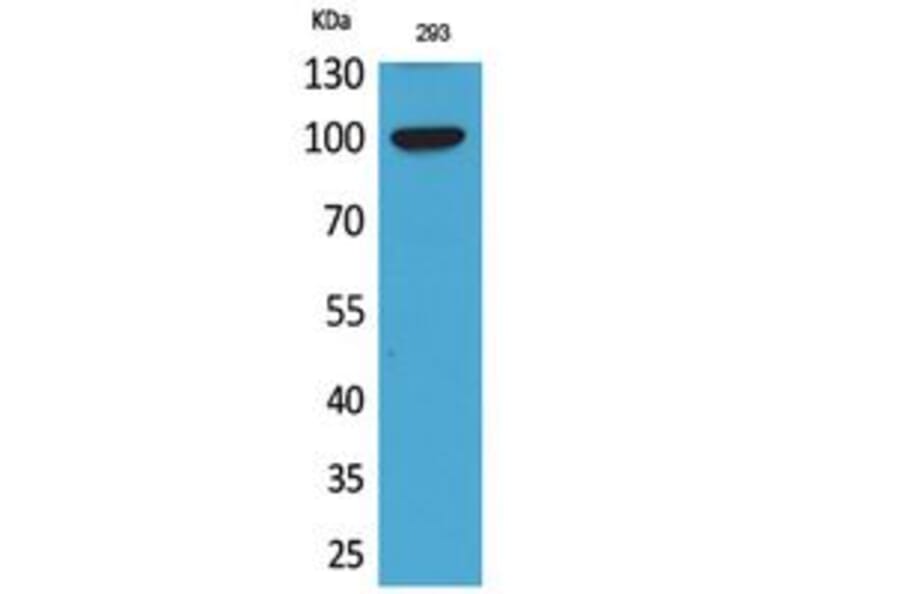 Western Blot - Anti-ENPP2 Antibody (C30050) - Antibodies.com