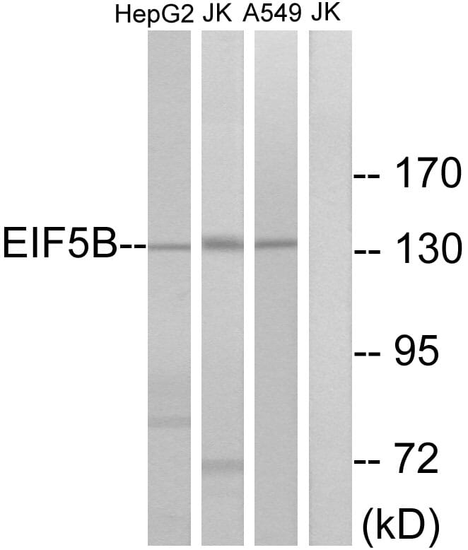 Western blot analysis of lysates from Jurkat, HepG and A549 cells using Anti-EIF5B Antibody. The right hand lane represents a negative control, where the antibody is blocked by the immunising peptide.
