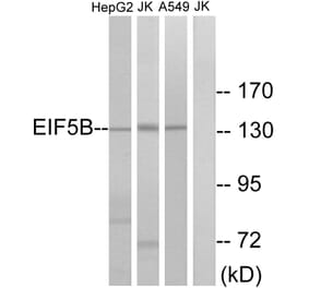 Western Blot - Anti-EIF5B Antibody (C15728) - Antibodies.com