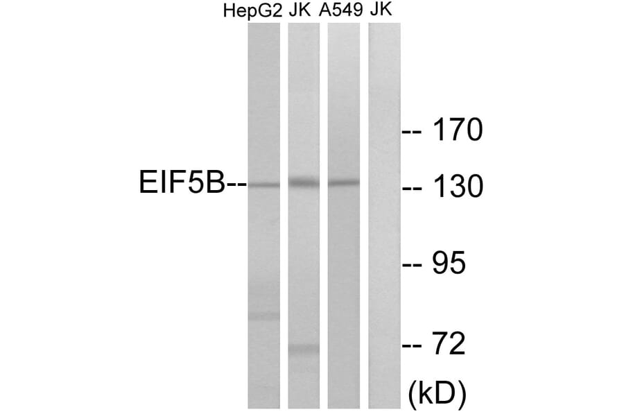 Western Blot - Anti-EIF5B Antibody (C15728) - Antibodies.com