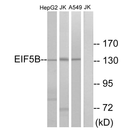 Western Blot - Anti-EIF5B Antibody (C15728) - Antibodies.com