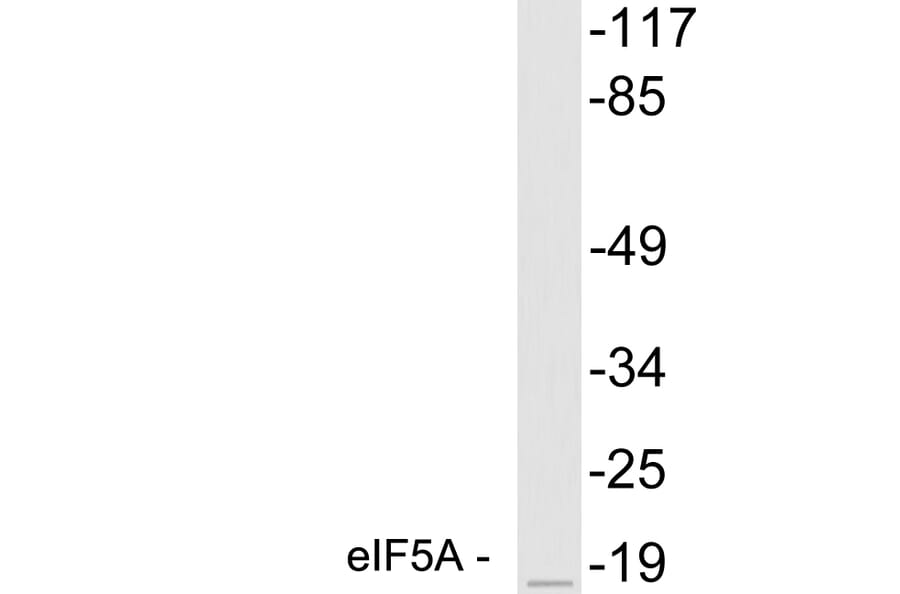 Western Blot - Anti-eIF5A Antibody (R12-2127) - Antibodies.com