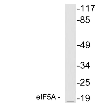 Western Blot - Anti-eIF5A Antibody (R12-2127) - Antibodies.com