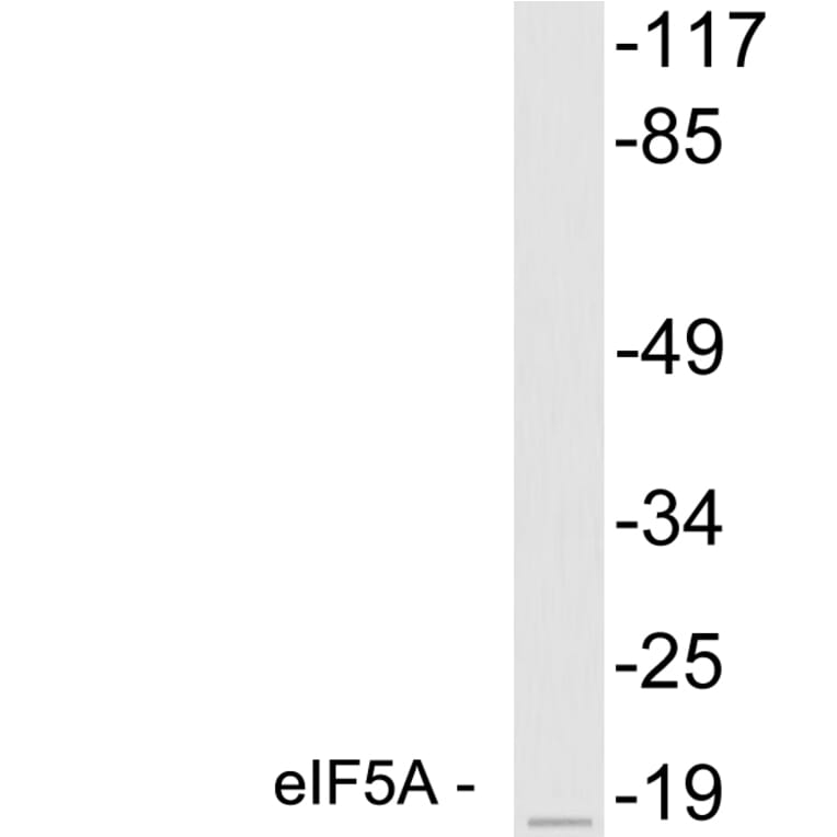 Western Blot - Anti-eIF5A Antibody (R12-2127) - Antibodies.com