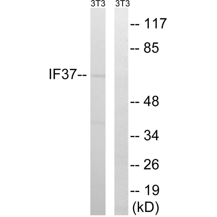 Western Blot - Anti-EIF3D Antibody (C15714) - Antibodies.com