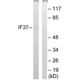 Western Blot - Anti-EIF3D Antibody (C15714) - Antibodies.com