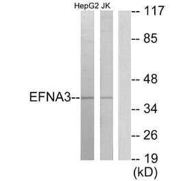 Western Blot - Anti-EFNA3 Antibody (C10709) - Antibodies.com
