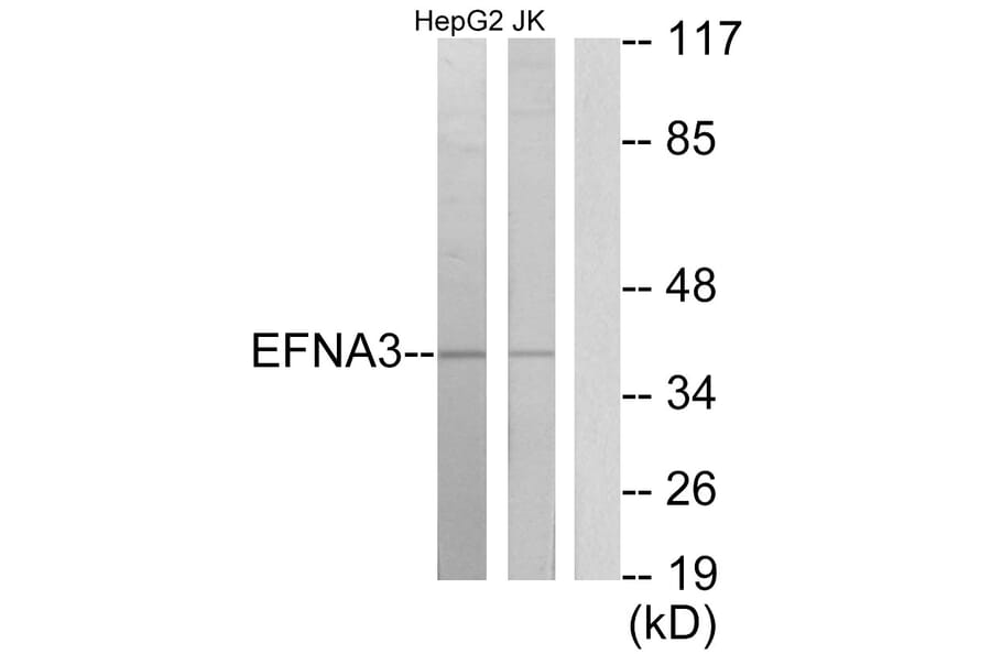 Western Blot - Anti-EFNA3 Antibody (C10709) - Antibodies.com