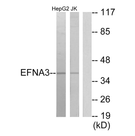 Western Blot - Anti-EFNA3 Antibody (C10709) - Antibodies.com