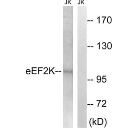 Western Blot - Anti-eEF2K Antibody (B8340) - Antibodies.com