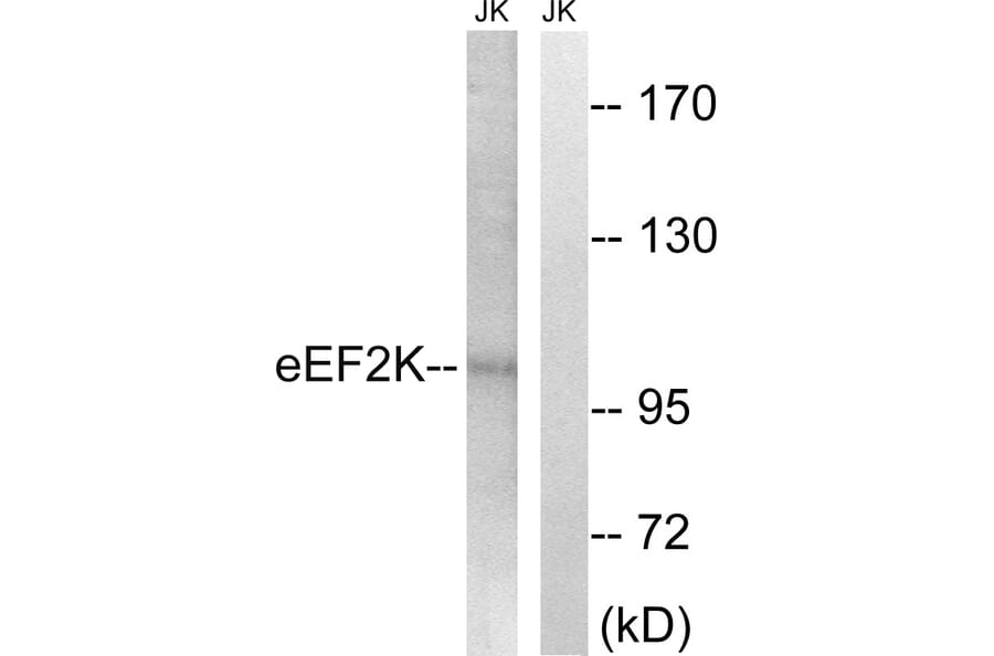 Western Blot - Anti-eEF2K Antibody (B8340) - Antibodies.com