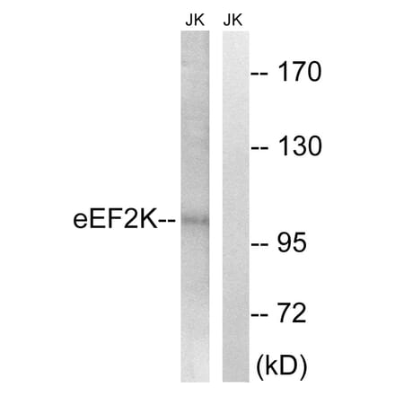 Western Blot - Anti-eEF2K Antibody (B8340) - Antibodies.com