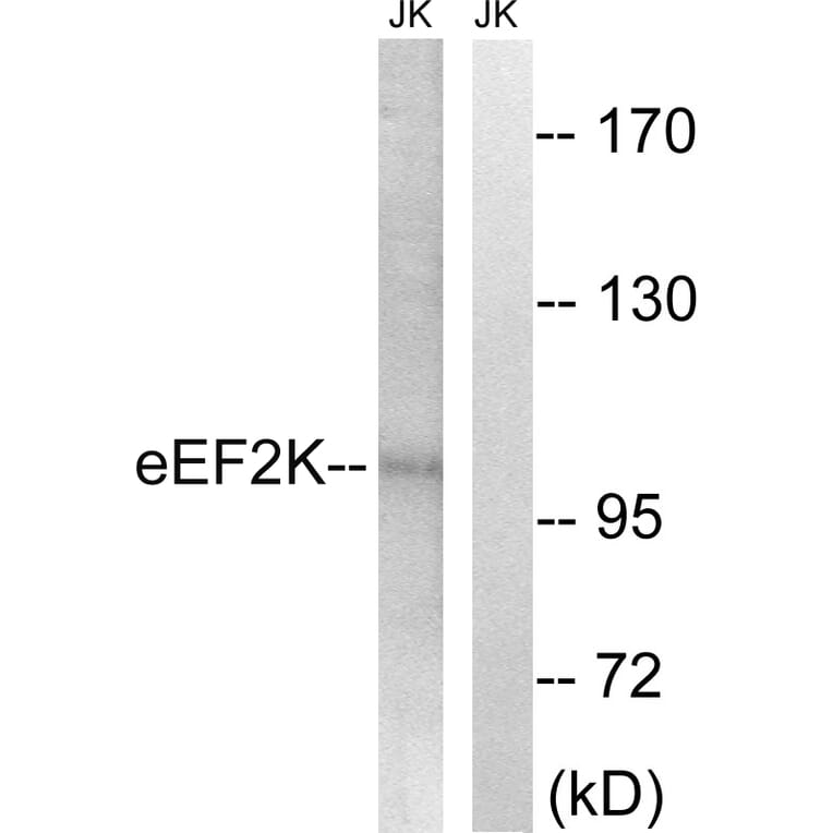 Western Blot - Anti-eEF2K Antibody (B8340) - Antibodies.com