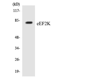 Western Blot - Anti-eEF2K Antibody (R12-2732) - Antibodies.com