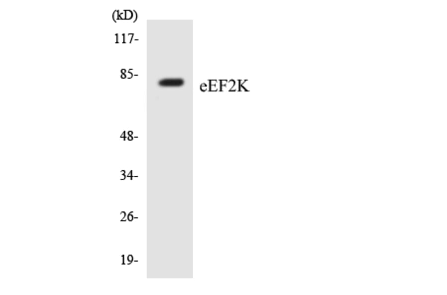 Western Blot - Anti-eEF2K Antibody (R12-2732) - Antibodies.com