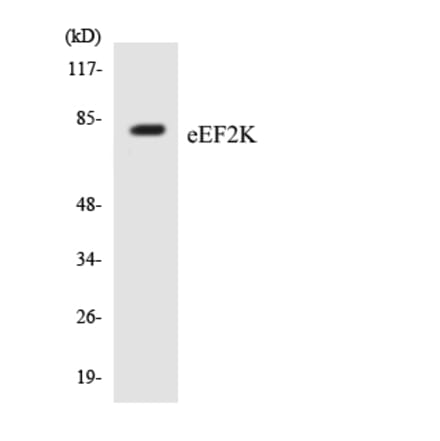 Western Blot - Anti-eEF2K Antibody (R12-2732) - Antibodies.com