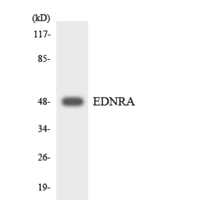 Western Blot - Anti-EDNRA Antibody (R12-2730) - Antibodies.com