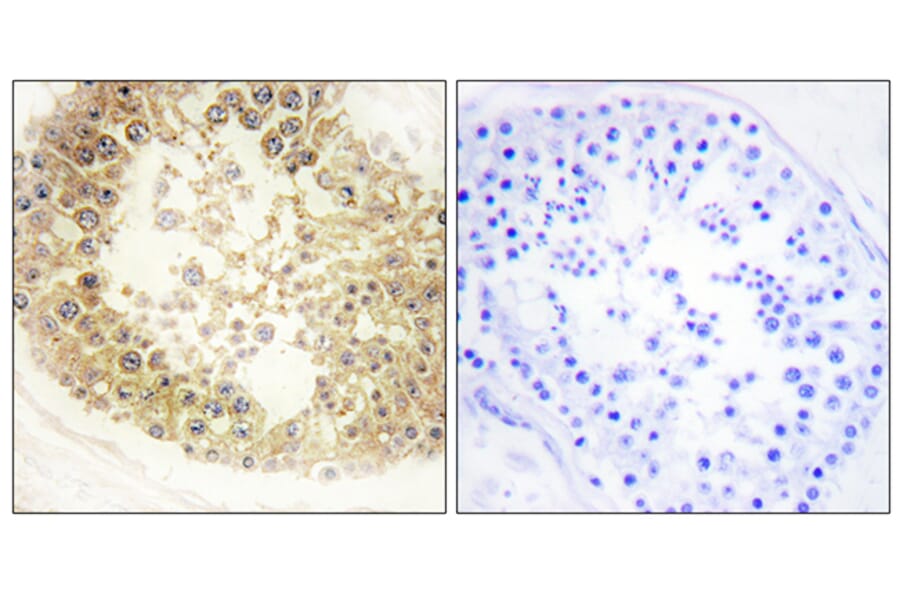 Immunohistochemistry - Anti-ECRG4 Antibody (C11679) - Antibodies.com