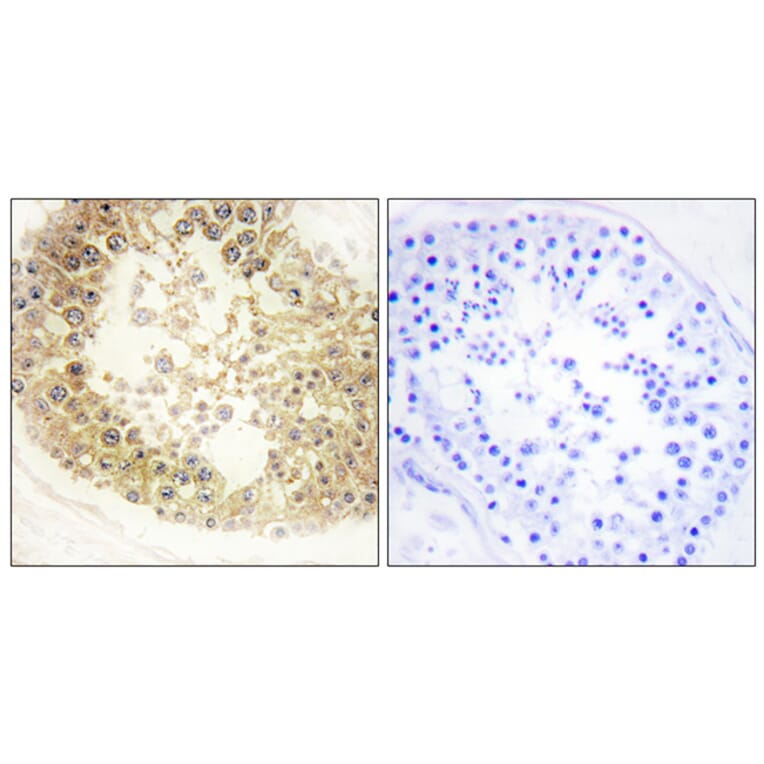 Immunohistochemistry - Anti-ECRG4 Antibody (C11679) - Antibodies.com